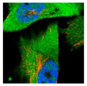 <a href="/product/SIGMA/HPA022959">Product No. HPA022959</a>: Immunofluorescent staining of human cell line U-251MG shows positivity in nucleus but not nucleoli and cytoplasm. Anti-ACLY