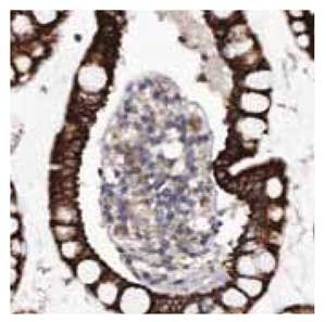 <a href="/product/SIGMA/HPA011994">Product No. HPA011994</a>: Immunohistochemical staining of human small intestine shows strong cytoplasmic positivity in glandular cells. Anti-MGLL