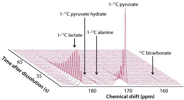 In vivo 13C MR spectra measured