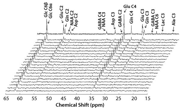 localized-13c-mr-spectra