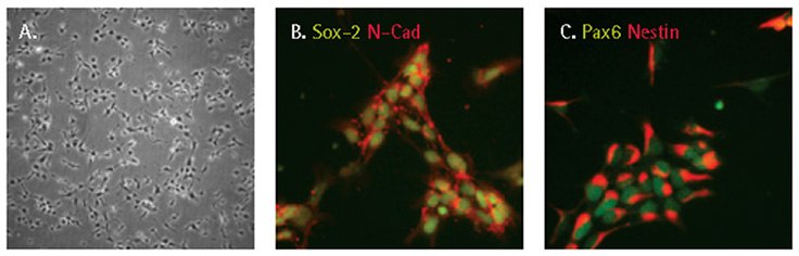 Characterization of iPSC derived neural progenitor cells