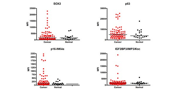 Graph showing data for cancer autoantibody analysis. Using MILLIPLEX® Human Cancer Autoantibody Panel Cat. No. HCABMAG-13K, the MFI (Median Fluorescence Intensity) values of the cancer autoantibody biomarkers were determined in cancer (breast, colorectal, ovarian, lung, prostate) (n=78) and healthy control (n=18) serum samples (samples diluted at 1:100).