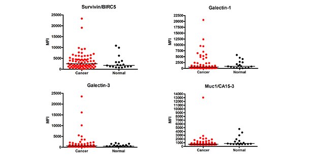 Graph showing data for cancer autoantibody analysis. Using MILLIPLEX® Human Cancer Autoantibody Panel Cat. No. HCABMAG-13K, the MFI (Median Fluorescence Intensity) values of the cancer autoantibody biomarkers were determined in cancer (breast, colorectal, ovarian, lung, prostate) (n=78) and healthy control (n=18) serum samples (samples diluted at 1:100).