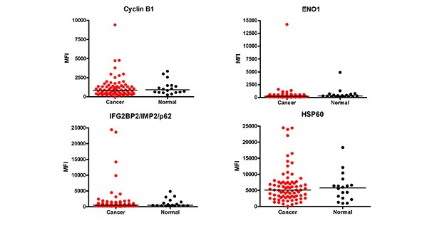 Graph showing data for cancer autoantibody analysis. Using MILLIPLEX® Human Cancer Autoantibody Panel Cat. No. HCABMAG-13K, the MFI (Median Fluorescence Intensity) values of the cancer autoantibody biomarkers were determined in cancer (breast, colorectal, ovarian, lung, prostate) (n=78) and healthy control (n=18) serum samples (samples diluted at 1:100).