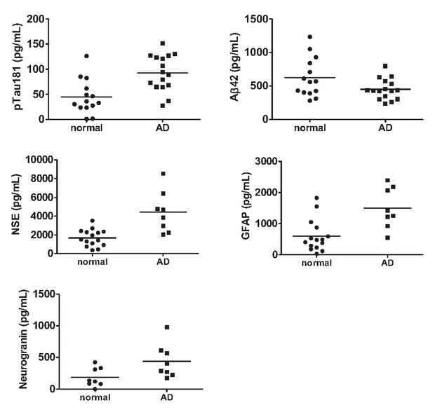MILLIPLEX® multiplex biomarker analysis of normal and AD CSF samples, including pTau181, NSE, Neurogranin, Aβ42, and GFAP.