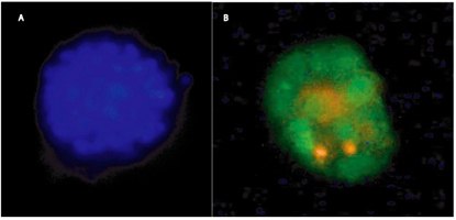 3-D Culture of MCF-10A Breast Cancer Cells using 3-D Culture Matrix™ Laminin I for 15 days in the presence of 2% Liminin I in Assay Medium, and stained using A) CPA Dye 2, and B) SYBR<sup>®</sup> Green (nuclear) and propidium iodine (dead or necrotic). 3-D Culture of MCF-10A Breast Cancer Cells using 3-D Culture Matrix™ Laminin I for 15 days in the presence of 2% Liminin I in Assay Medium, and stained using A) CPA Dye 2, and B) SYBR® Green (nuclear) and propidium iodine (dead or necrotic).