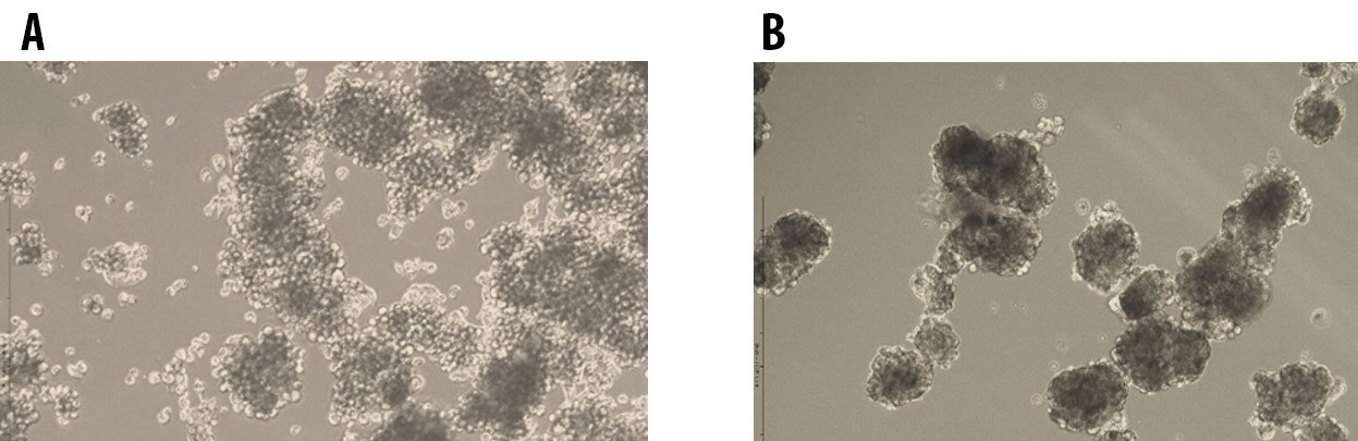Tumorsphere formation of E006AA Prostate Cancer Cells at Passage 1 (A) and Passage 5 (B) cultured in 3dGRO™ Spheroid Medium. Turmosphere Formation of E006AA