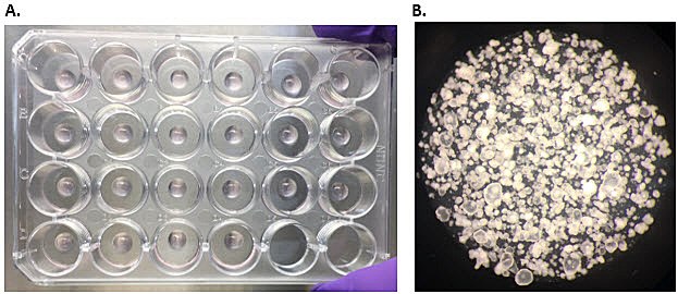 Human colon organoids. A) Colonic organoids encapsulated in Matrigel® matrix domes, two days post-thaw. B) By day 10-12 in culture, colon organoids occupy 85-90% of the dome, and are ready to be passaged.