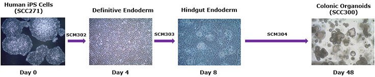 Human colonic organoid differentiation workflow. Human colonic organoids can be generated from human iPS cells using a three-step differentiation protocol through definitive endoderm, hindgut endoderm, and colonic organoid expansion stages. SCM302: Definitive Endoderm Induction Medium, SCM303: Hindgut Induction Medium, SCM304: 3dGRO™ Human Colon Organoid Expansion Medium