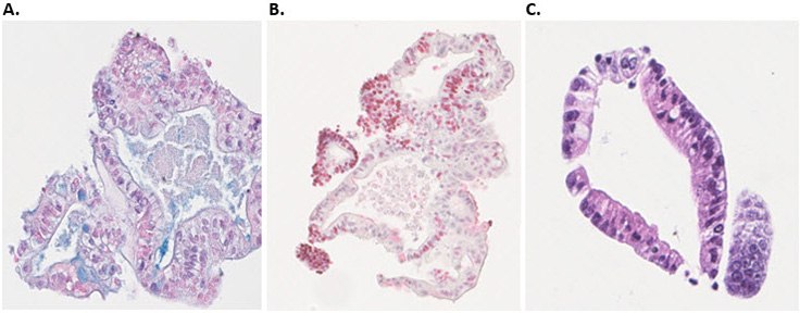 Immunohistochemical (IHC) characterization of human colon organoids. A) Goblet cells identified with alcian blue staining B) proliferating cells identified using Ki67 antibody (red) C) nuclei and plasma protein identified using H&E staining.