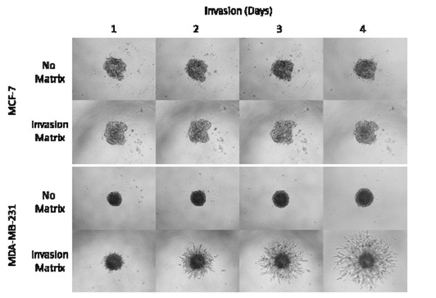 Morphology of MCF-7 and MDA-MB-231 cell