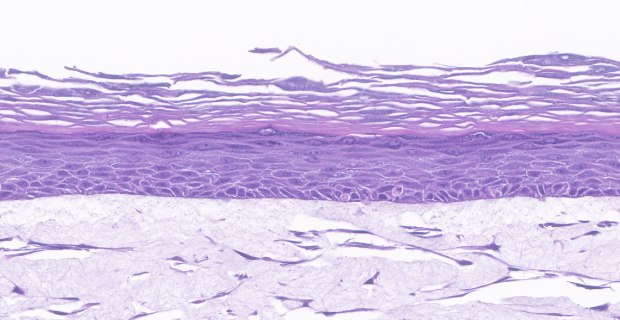 Millicell Skin Anti-Flaggrin Stain In vitro organotypic skin culture model