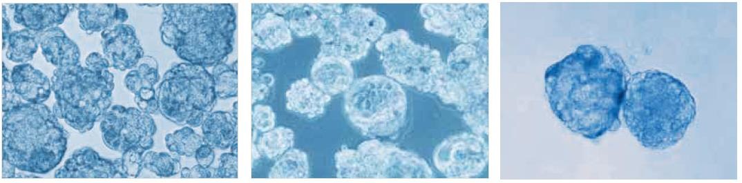 <b>Tumorsphere culture of MCF-7 breast cancer cells in the PromoCell 3D Tumorsphere Media XF after 10 passages</b>. The tumorsphere culture was subject to serial passage every 9 days by enzymatic dissociation according to the protocol. Robust tumorsphere formation was maintained during serial culture Tumorsphere culture of MCF-7 breast cancer cells in the PromoCell 3D Tumorsphere Media XF after 10 passages