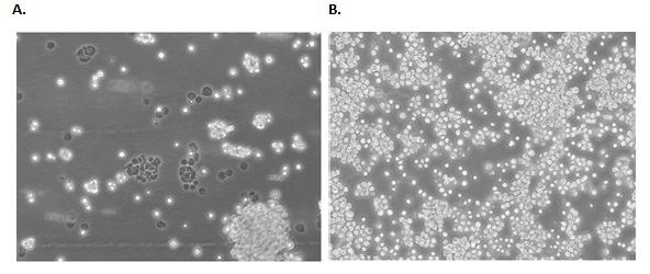 B95-8 cells 24 hours (A) and 72 hours (B) post freeze/thaw show semi-adherent fibroblastic and lymphoblastic morphology. Confluence should carefully be monitored and passaged when cells reach ~80% confluency. semi-adherent cell line