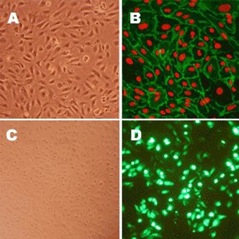 Human Aortic Endothelial Cells (HAOEC) Human Aortic Endothelial Cells (HAOEC)