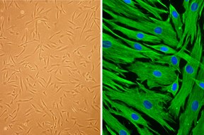 Human Follicle Dermal Papilla Cells (HFDPC)