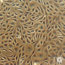 Bovine Coronary Artery Endothelial Cells (BCAEC) b300-05-cells