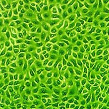 Bovine Endometrial Endothelial Cells (BEnEpC) b932-05-cells