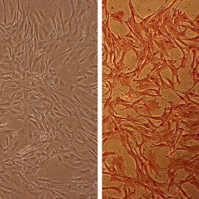 Bovine Aortic Smooth Muscle Cells (BAOSMC) Bovine Aortic Smooth Muscle Cells (BAOSMC)