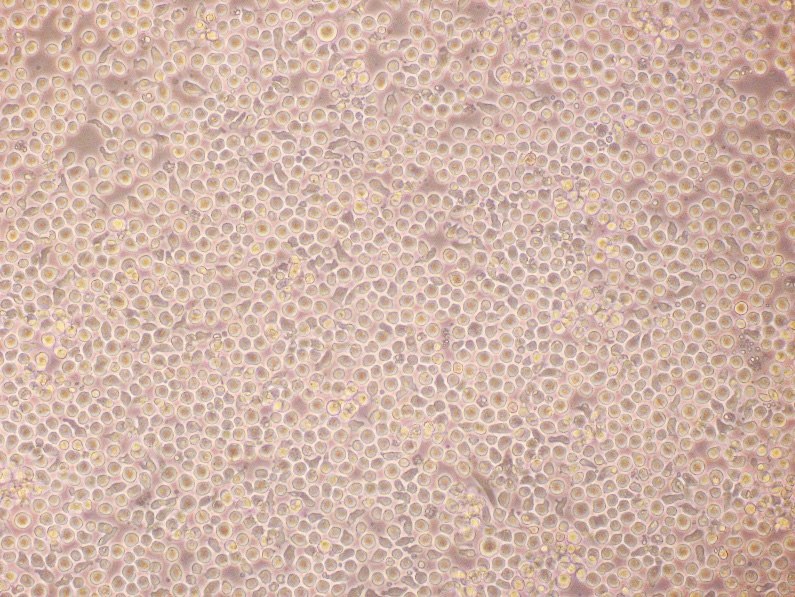 Expansion of human hematopoietic stem cells Expansion of human hematopoietic stem cells