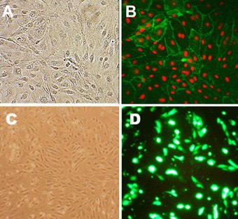 Human Lung Microvascular Endothelial Cells (HLMVEC) human lung microvascular