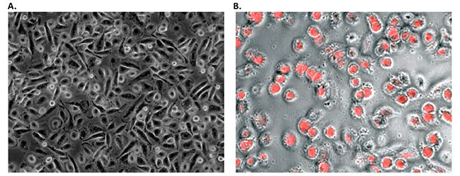 Morphology and phagocytic activity of human PBMC derived M1 macrophages.
