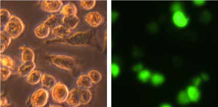 Morphology and phagocytic activity of human PBMC derived M2 macrophages.