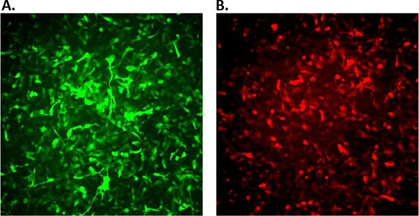 Fluorescence images of ReNcell VM infected with APPSL-GFP