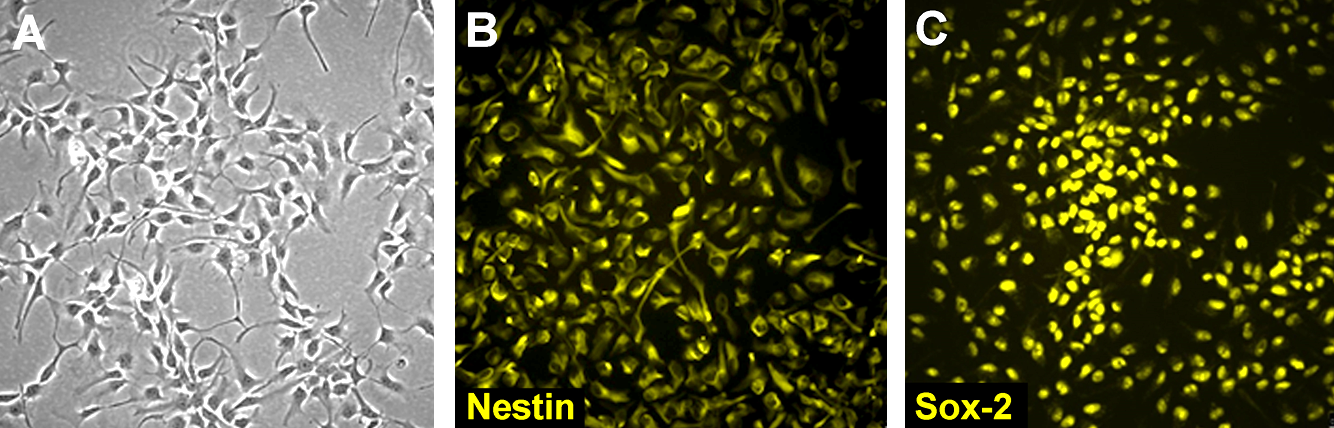 Human neural stem cell lines