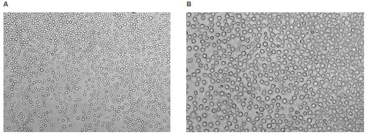 Morphology of human CD34+ hematopoietic progenitor cells 10X