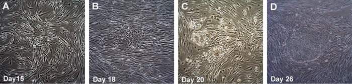 The transfected HFFs were replated onto inactive MEFs at Day 10, Colonies start to emerge from Day 15-16 and are more obvious around day 17-20 (A, B). Colonies are ready to be picked at Day 26. Time course of human iPSC colonies generation using Human Simplicon RNA Reprogramming Kit