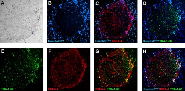 Fully reprogrammed human iPS cells express human pluripotent markers, TRA-1-60 FITC (D, E, G, H, green) and SSEA-4 PE (C, F, G, H, red) while downregulating the fibroblast marker, CD13 PE (data not shown). Cells were stained with cell permeable Hoechst nuclear dye (B, C, D, H, blue). Fully reprogrammed human iPS cells exhibit Hoechst dim phenotype (see colony center in B, C, D, H) while non-iPS and differentiated cells exhibit a Hoechst bright phenotype (see the periphery of the colony in B, C, D, H, which is surrounded by fibroblast cells and are Hoechst bright). Human iPS colonies at passage 5 were used for live staining. Fully reprogrammed human iPS cells express human pluripotent markers