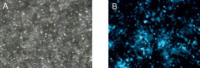 Transfection efficiency after 48 hours. Delivery of high amounts of viral plasmids into packaging cells using X-tremeGENE HP Transfection Reagent. (A) bright field microscopy, (B) fluorescence microscopy. Transfection efficiency