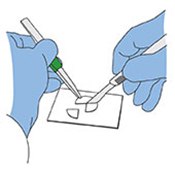 Cutting quarters from particle-laden 25 mm filter for subsequent clearing and microscopic examination.