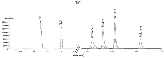 Calibration Calibration