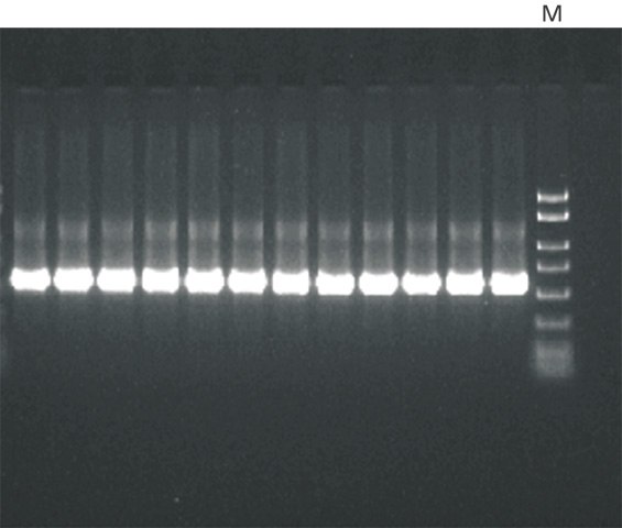 PCR amplification of a 500 bp product isolated from genomic DNA. Genomic DNA from soybean leaves was purified using the GenElute™ Plant Genomic DNA Miniprep Kit. A 5 μL aliquot of eluate was used as template in a 20 μL total PCR reaction for 30 cycles. A 5 μL aliquot of each PCR reaction was resolved on a 2% precast agarose gel (Cat. No. P5722). The PCR marker (M) used (Cat. No. P9577) ranged from 50 bp to 2 kb. PCR amplification