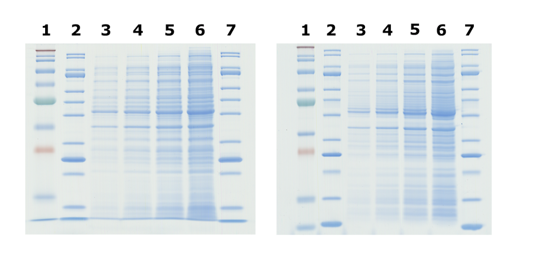 Comparison of Tris-Glycine (left) and Bis-Tris (right) gels