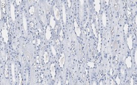 Anti-Atg5 Antibody, clone 1L18 ZooMAb® Rabbit Monoclonal recombinant, expressed in HEK 293 cells