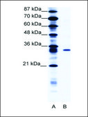 Anti-KCNIP4 antibody produced in rabbit affinity isolated antibody
