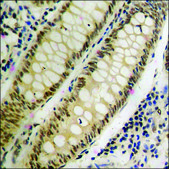 Anti-phospho-MEF2A (pThr312) antibody produced in rabbit affinity isolated antibody