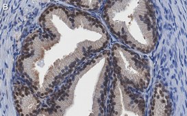 Anti-PRMT5 Antibody, clone 1H16 ZooMAb® Rabbit Monoclonal recombinant, expressed in HEK 293 cells