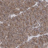 Anti-SCRIB antibody produced in rabbit Prestige Antibodies® Powered by Atlas Antibodies, affinity isolated antibody, buffered aqueous glycerol solution
