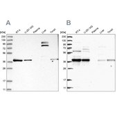 Anti-TBCC antibody produced in rabbit Prestige Antibodies® Powered by Atlas Antibodies, affinity isolated antibody, buffered aqueous glycerol solution