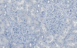 Anti-Rab7A Antibody, clone 4E15 ZooMAb® Rabbit Monoclonal recombinant, expressed in HEK 293 cells