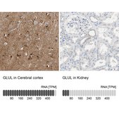 Anti-GLUL antibody produced in rabbit Ab2, Prestige Antibodies® Powered by Atlas Antibodies, affinity isolated antibody, buffered aqueous glycerol solution