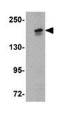 抗-PALB2抗体 from rabbit, purified by affinity chromatography