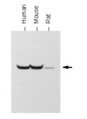 Anti-ATP Synthase subunit β Antibody, clone 11/21-7-A8 clone 11/21-7-A8, from mouse
