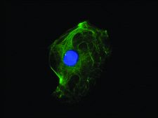 Monoclonal Anti-Cytokeratin, pan (Mixture) antibody produced in mouse clone C-11+PCK-26+CY-90+KS-1A3+M20+A53-B/A2, ascites fluid
