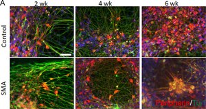 Anti-Peripherin Antibody serum, Chemicon®