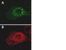 LentiBrite GFP-p62 Lentiviral Biosensor